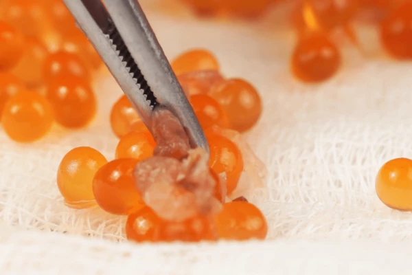 Пинцетом аккуратно убираем свернувшиеся ястыковые пленки. 